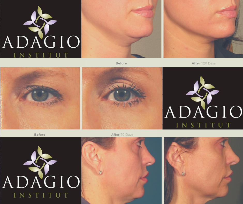 Institut Adagio | 1546 QC-277, Lac-Etchemin, QC G0R 1S0, Canada | Phone: (418) 625-3349