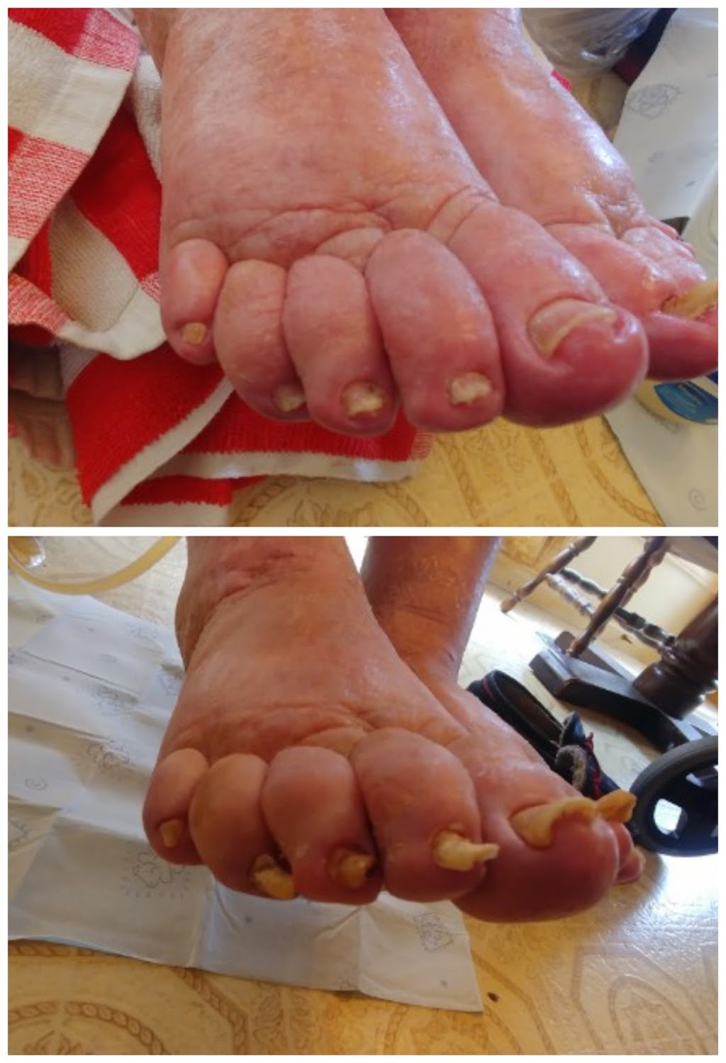 Jennifers Mobile Nursing Foot Care | Liberty St S, Bowmanville, ON L1C 2W1, Canada | Phone: (289) 892-5615