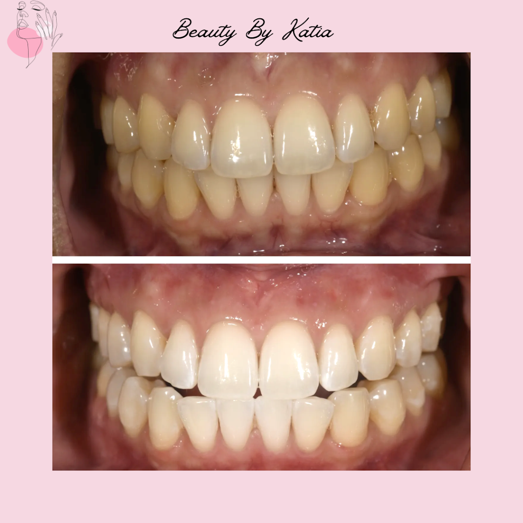 Beauty By Katia | 32 Port Arthur Cres, Richmond Hill, ON L4E 3N9, Canada | Phone: (647) 201-4634