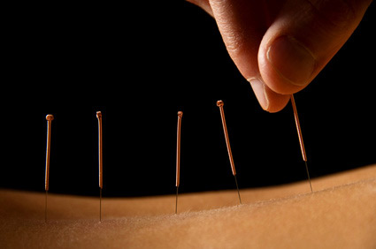 Dominic Ferland, Acupuncteur | 3871 Rue Nina, Laval, QC H7P 1E8, Canada | Phone: (514) 742-5534