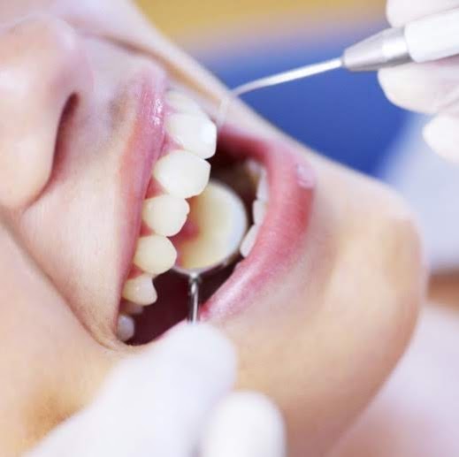 Dental Hygiene & Wellness Clinic | 37 Goulding Ave, Hamilton, ON L9C 5L5, Canada | Phone: (905) 746-7879