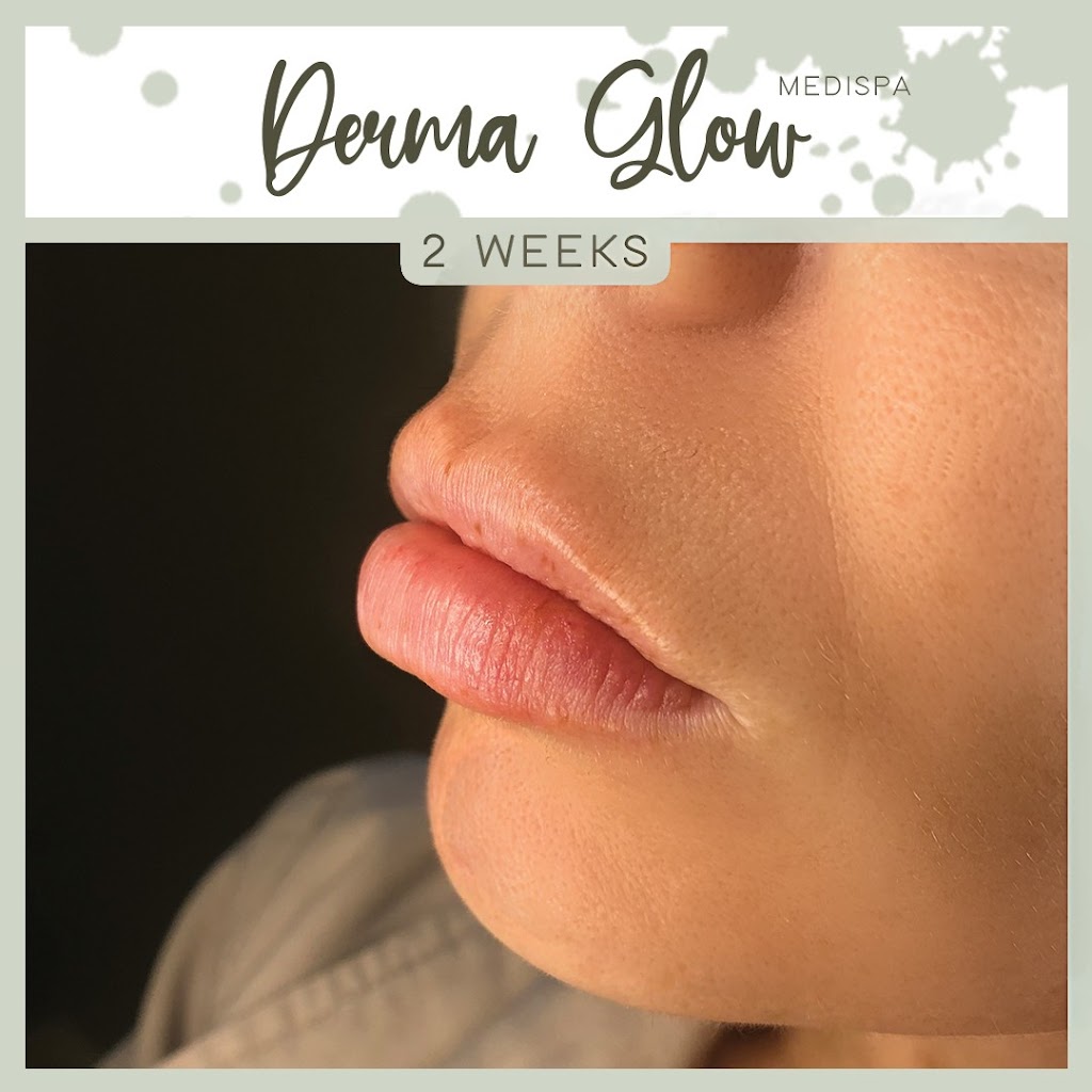 Derma Glow Medispa | 1389 Wallbridge Loyalist Rd, Belleville, ON K8N 4Z5, Canada | Phone: (613) 885-2804