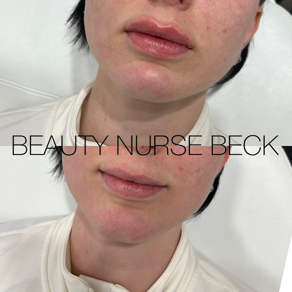 Beauty Nurse Beck - Seaforth | 39 Main St S, Seaforth, ON N0K 1W0, Canada | Phone: (226) 338-9202