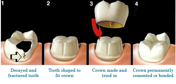 Dr.Hilma Rodriguez Family & Cosmetic Dentistry | 1275 Kensington Plaza Unit 7, Brockville, ON K6V 6C3, Canada | Phone: (613) 342-7070