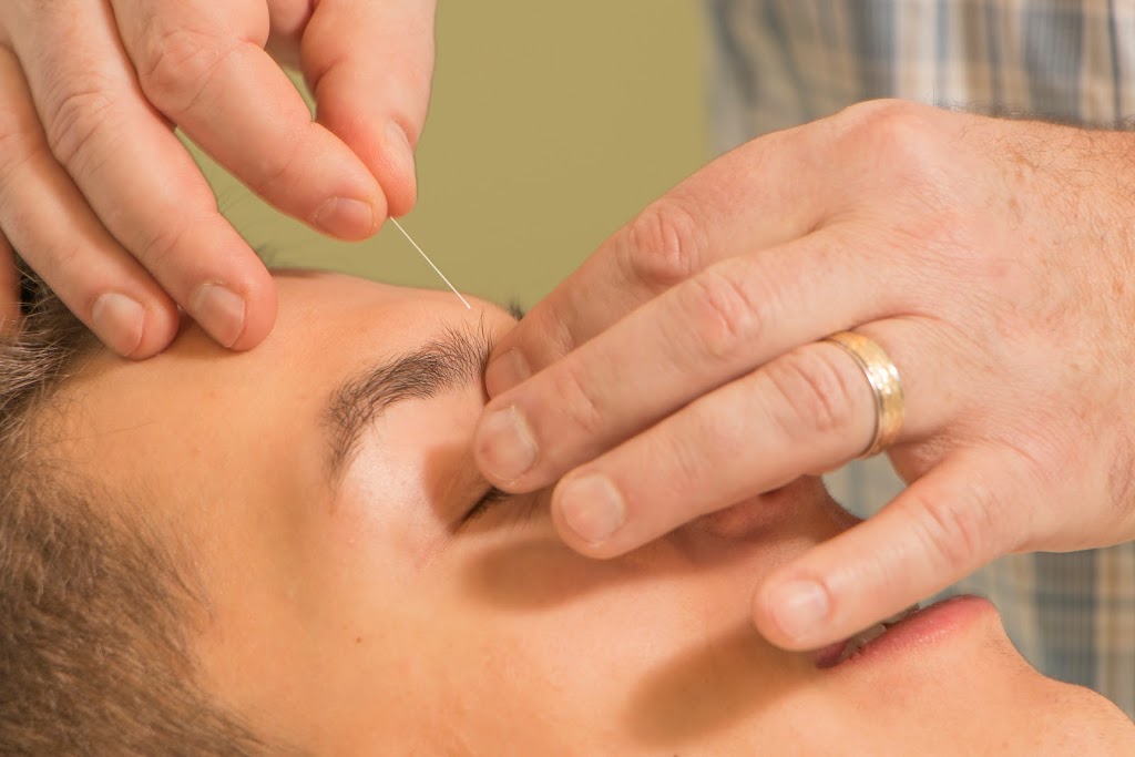 Rebalance Acupuncture Edmonton | 11356 119 St NW, Edmonton, AB T5G 2X4, Canada | Phone: (780) 801-1667