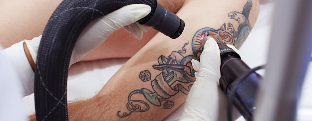 Nanaimo Tattoo Removal | 1925 Bowen Rd Unit #200, Nanaimo, BC V9S 1H1, Canada | Phone: (250) 327-7579