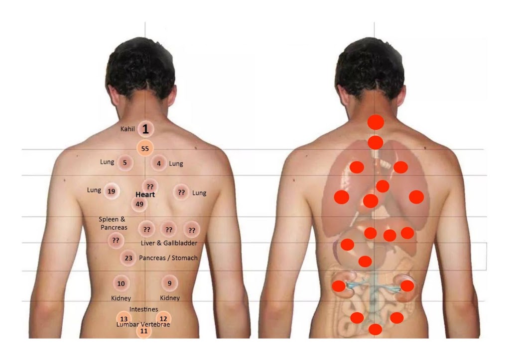 Holistic Fix - Hijama For Her | 2358 Esprit Dr, Ottawa, ON K4A 0T5, Canada | Phone: (647) 807-7265