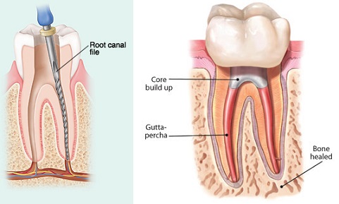 Oshawa Dentists | 53 Conlin Rd E, Oshawa, ON L1H 7K4, Canada | Phone: (905) 925-5194