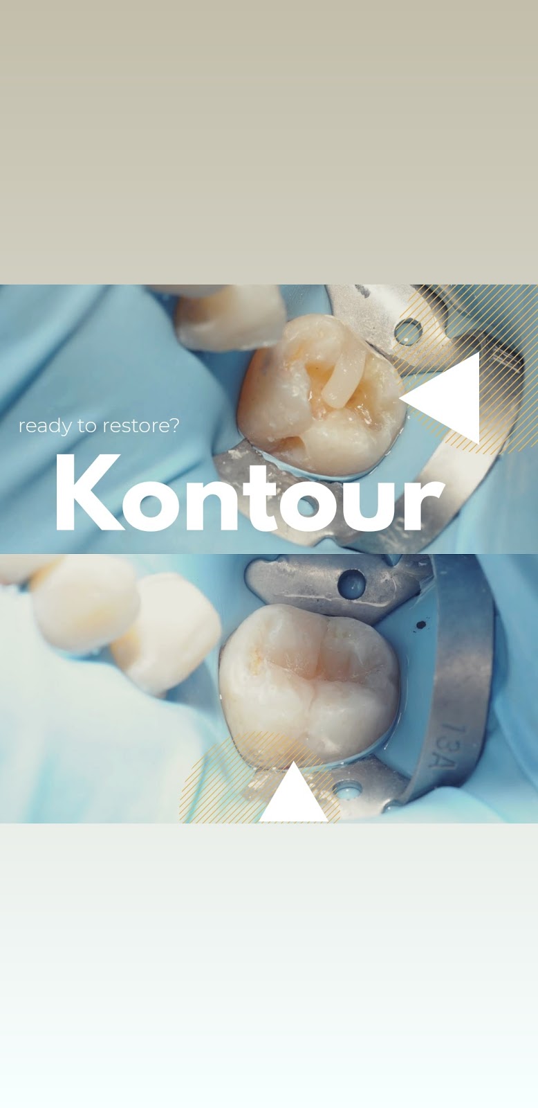 Kontour Dental Care | 8221 Campeau Dr unit a, Kanata, ON K2T 0A2, Canada | Phone: (613) 672-3333