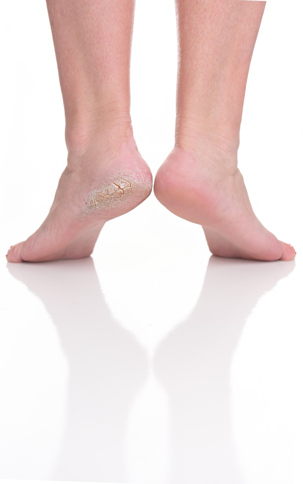 Footlogix Pediceuticals® | 1 Westside Dr Unit #12, Etobicoke, ON M9C 1B2, Canada | Phone: (416) 742-1313