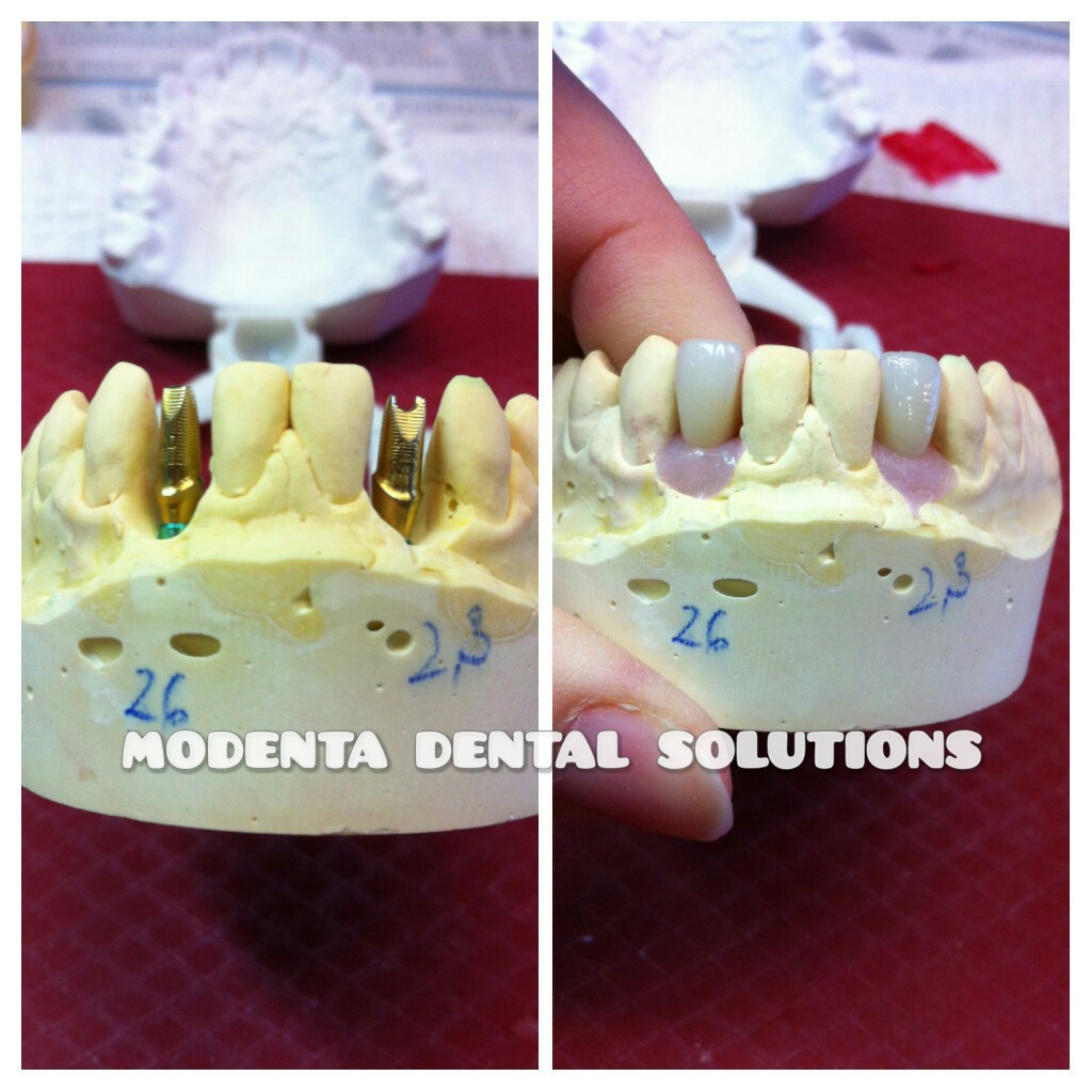 Modenta Dental Solutions Inc. | 160 East Beaver Creek Rd Unit 19, Richmond Hill, ON L4B 3L4, Canada | Phone: (289) 809-1180