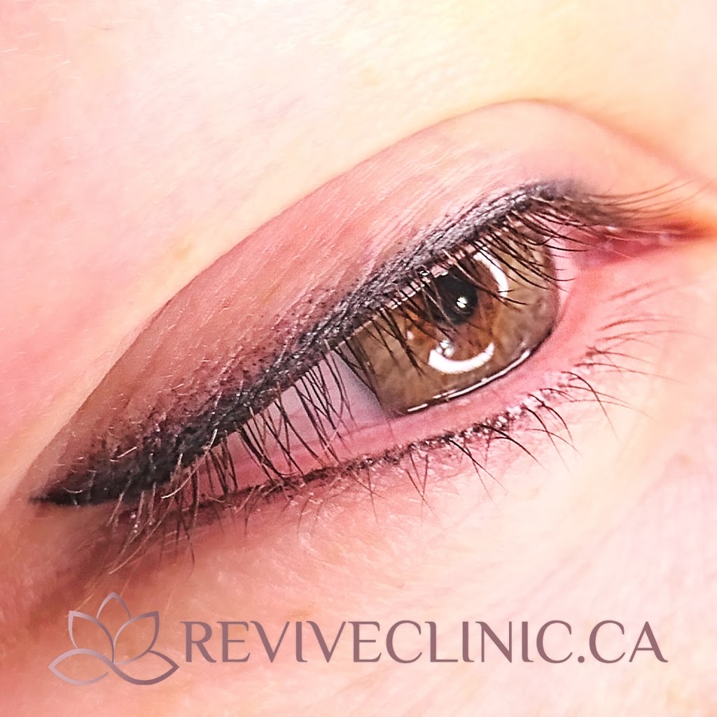 Revive Clinic Cosmetic Tattooing | 106 Wellman Crescent, Saskatoon, SK S7T 0J1, Canada | Phone: (306) 262-3282