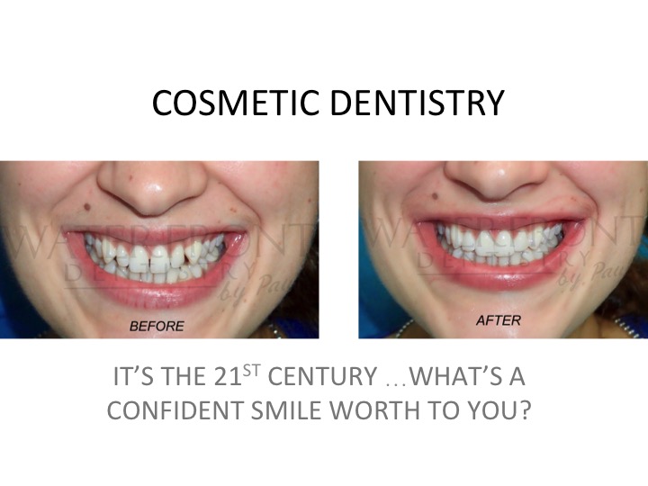 Waterfront Dentistry | 146 St Paul St, Belleville, ON K8N 1B3, Canada | Phone: (613) 966-1225