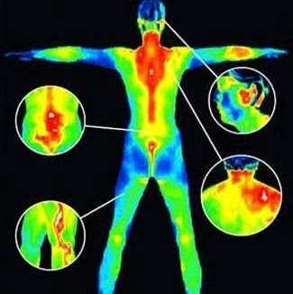 HealthSCAN Thermography | 2400 Brant St, Burlington, ON L7P 4N3, Canada | Phone: (905) 220-3821