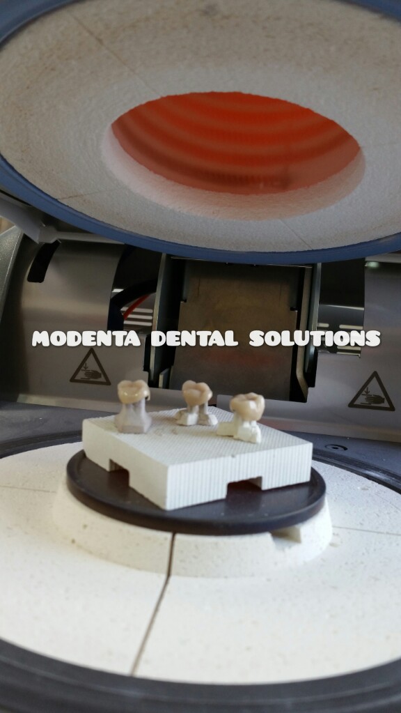 Modenta Dental Solutions Inc. | 160 East Beaver Creek Rd Unit 19, Richmond Hill, ON L4B 3L4, Canada | Phone: (289) 809-1180