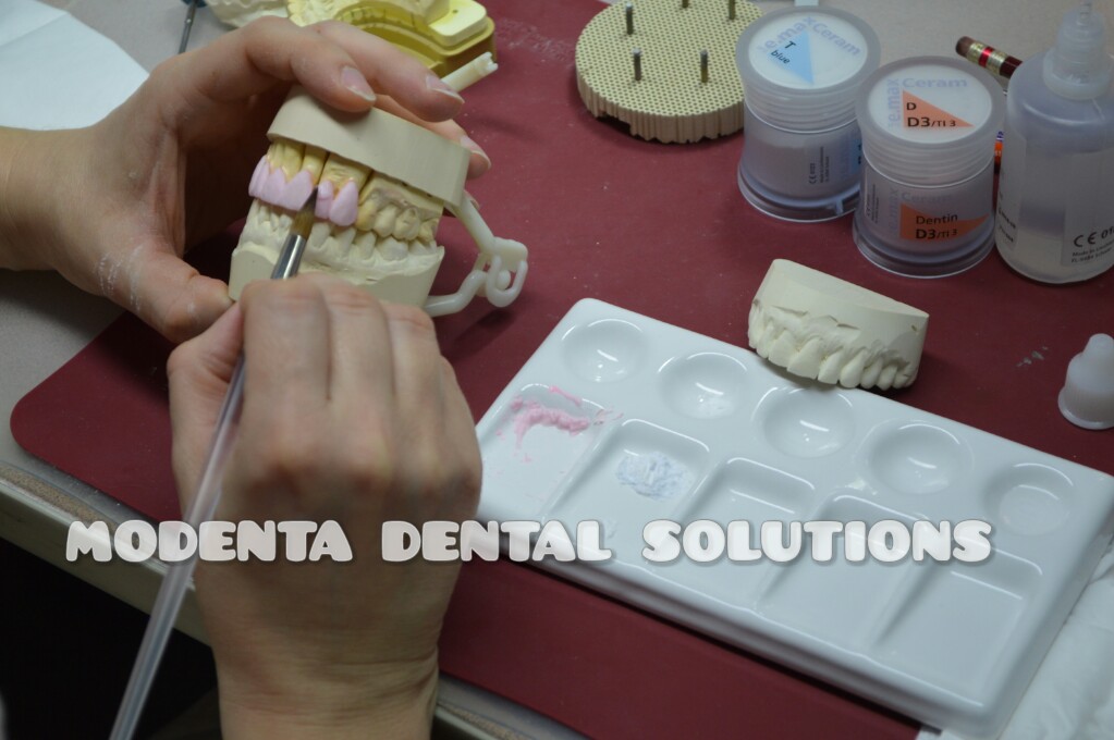 Modenta Dental Solutions Inc. | 160 East Beaver Creek Rd Unit 19, Richmond Hill, ON L4B 3L4, Canada | Phone: (289) 809-1180