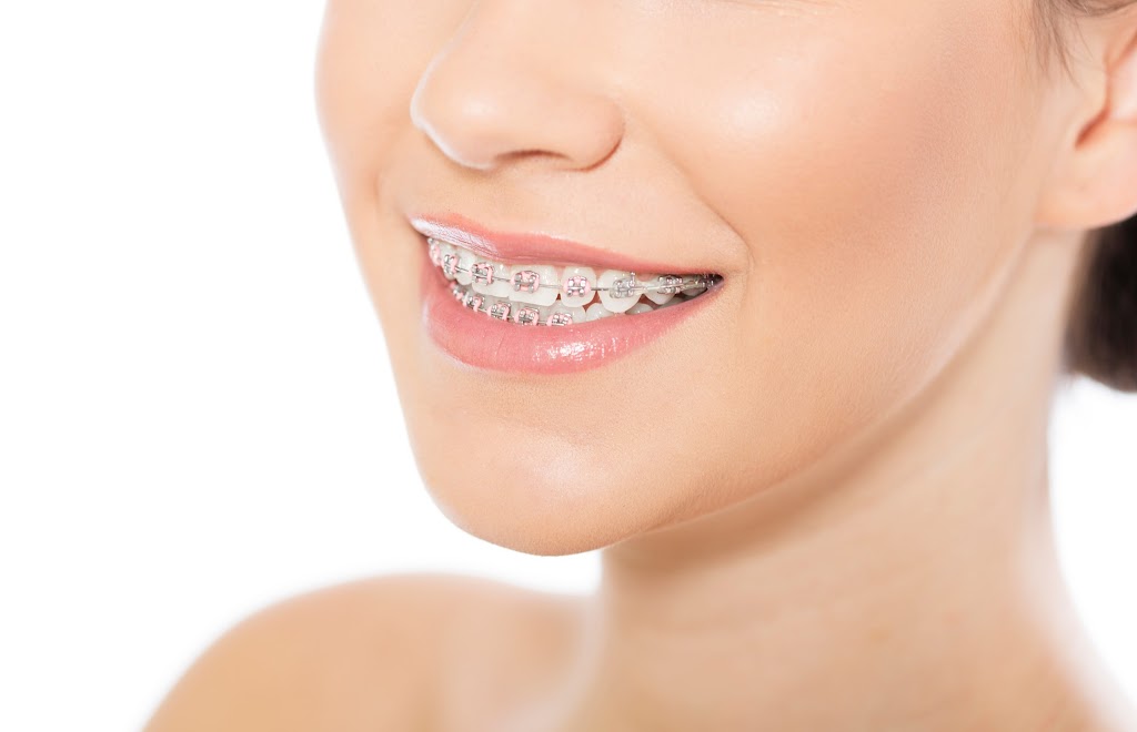 Braceland Orthodontists | 3420 Finch Ave E #403, Scarborough, ON M1W 2R6, Canada | Phone: (416) 497-2122