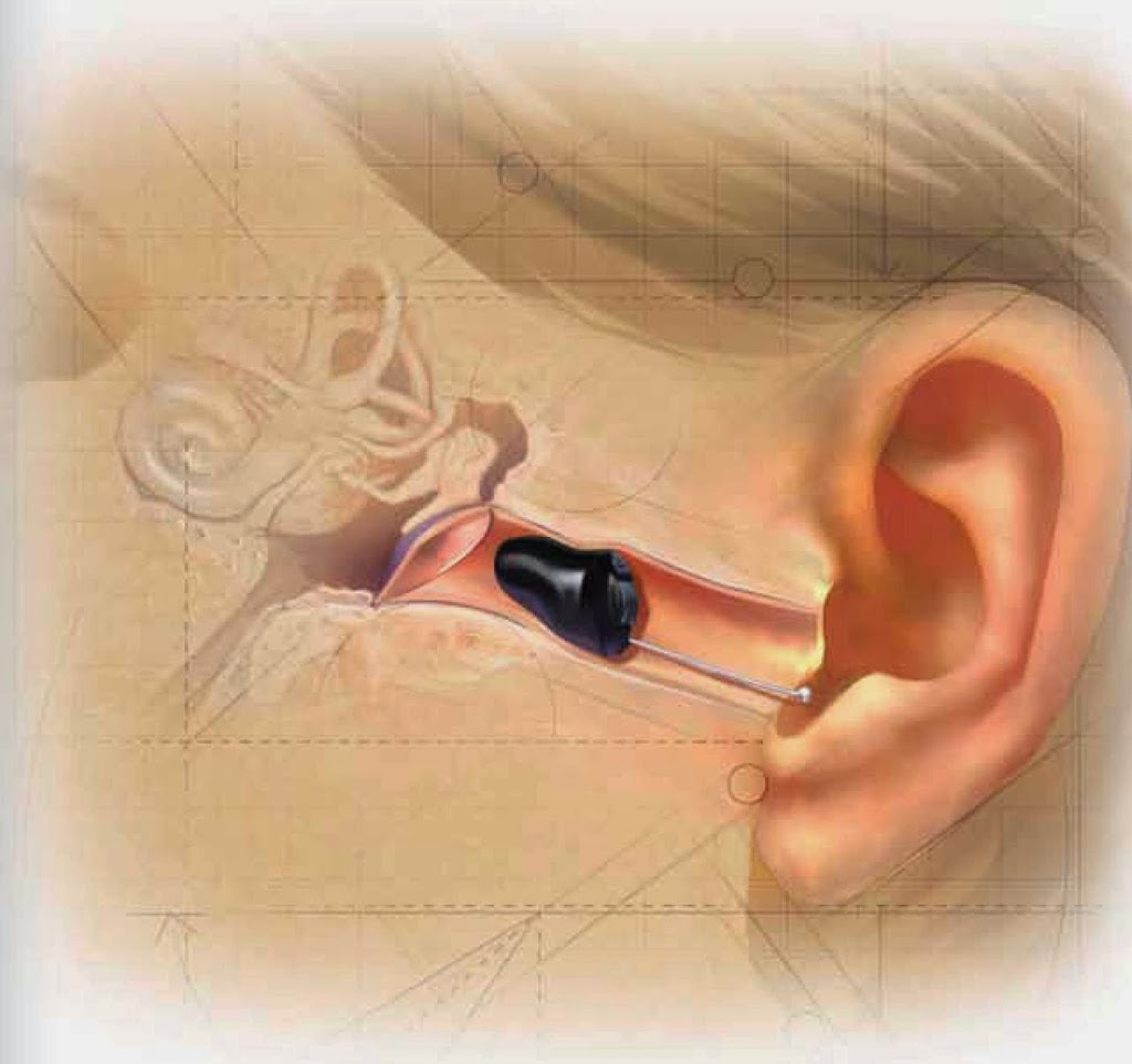 NexGen Hearing | 1516 Fairfield Rd #10, Victoria, BC V8S 1G1, Canada | Phone: (250) 590-2088