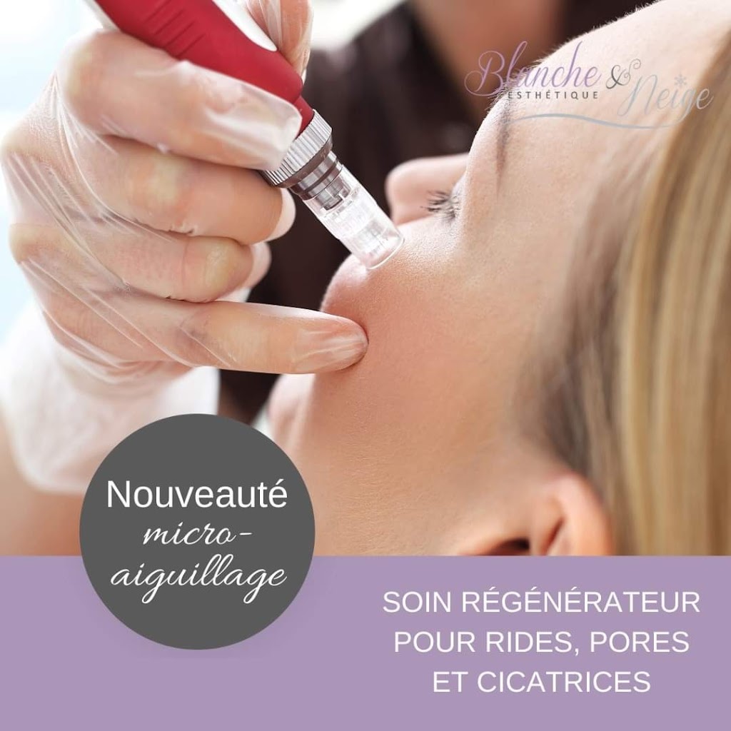 Esthétique Blanche & Neige | 1262 Chem. du Bord-de-lEau, Laval, QC H7Y 1B6, Canada | Phone: (450) 689-8844