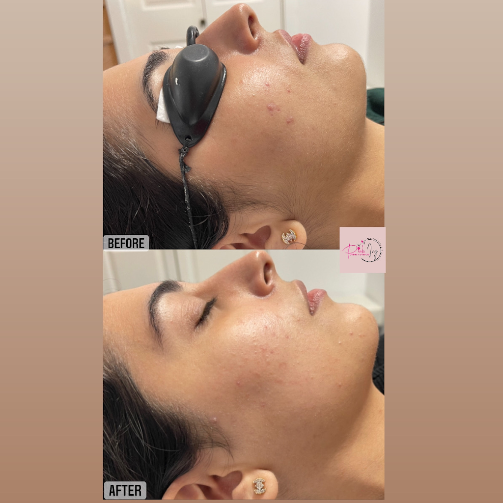 Pink ivy Laser & skin care studio | 12541 89a Ave, Surrey, BC V3V 1A9, Canada | Phone: (604) 655-8485