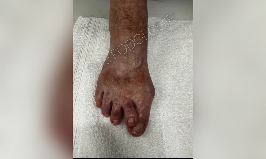 SMJ PODOLOGIE Soins de pieds à domicile | 359A Rang de la Rivière Sud-Ouest, Maskinongé, QC J0K 1N0, Canada | Phone: (514) 318-2050