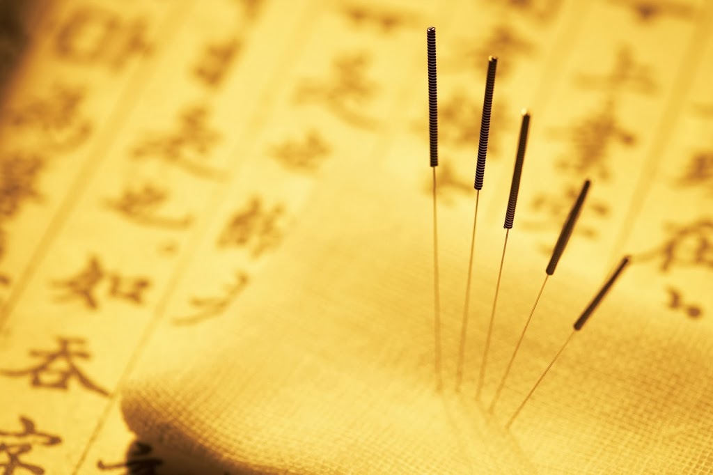 Impulse Acupuncture | 15399 102a Ave #101, Surrey, BC V3R 7K1, Canada | Phone: (604) 951-8959