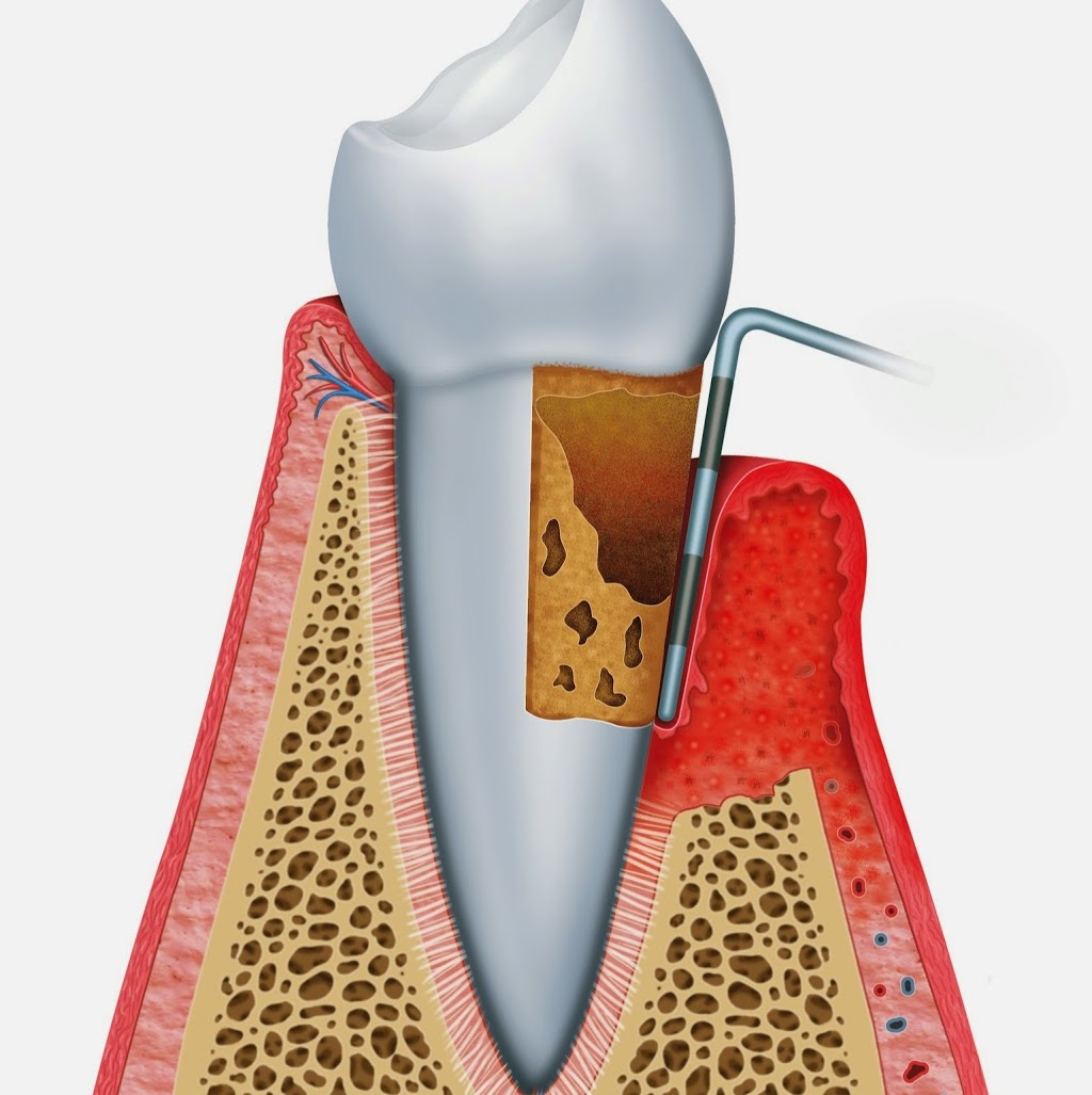 College of Dental Auxiliaries, Canada (CDAC) | 2280 Bovaird Dr E 7- 8 & 9B, Brampton, ON L6R 3J5, Canada | Phone: (905) 792-0855