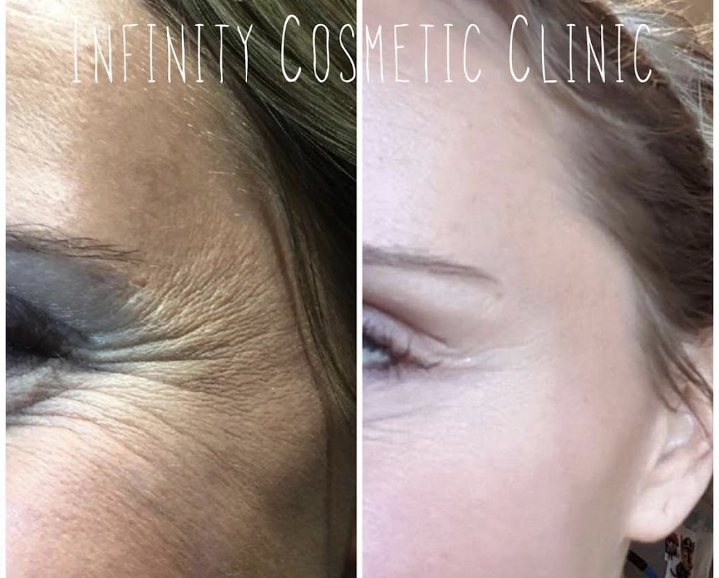 Infinity Cosmetic Clinic | 180 Pinebush Rd, Cambridge, ON N1R 7H8, Canada | Phone: (519) 740-7555