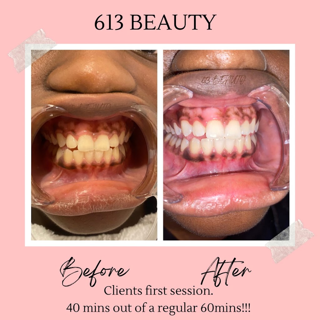 613 Beauty Ltd | 1959 Montmère Ave, Orléans, ON K4A 0E3, Canada | Phone: (613) 408-0822