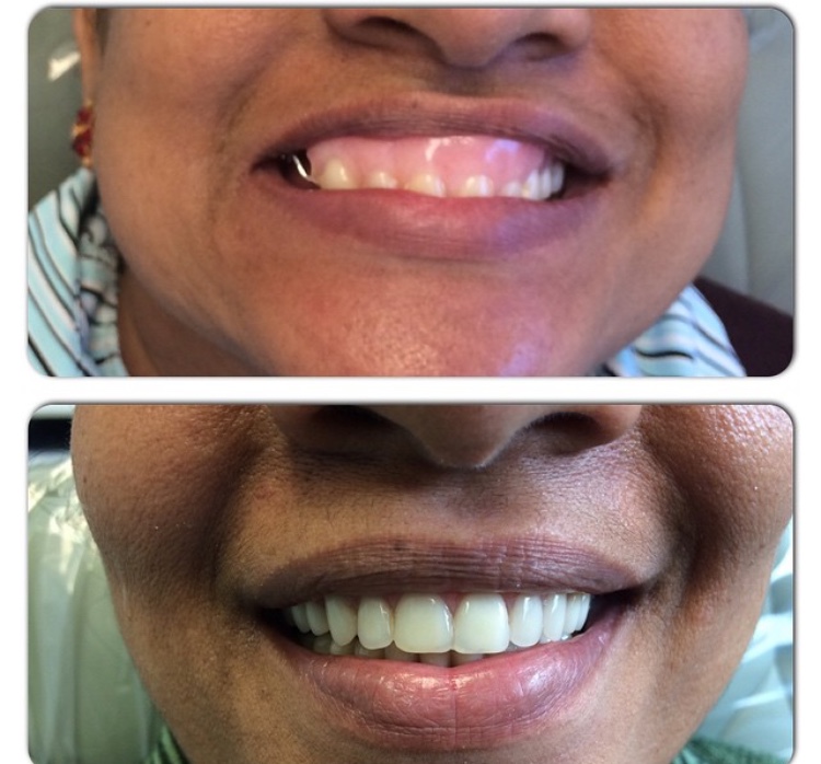 Great Smile Denture Clinic Inc | 566 Sheppard Ave W, North York, ON M3H 2R9, Canada | Phone: (416) 398-7846