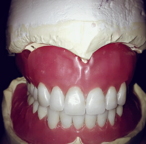 Happy Smile Denture Clinic | 2354 Major MacKenzie Dr W, Maple, ON L6A 3Y7, Canada | Phone: (905) 303-5550