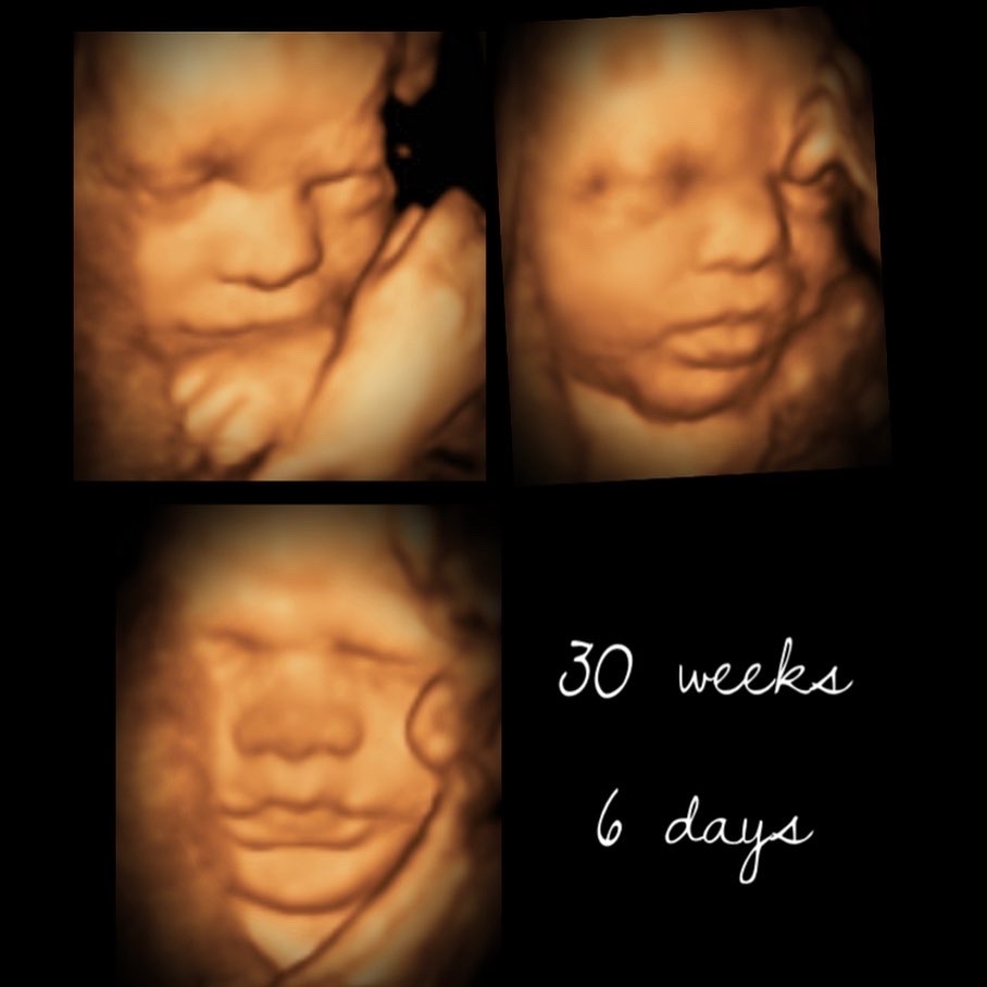 Prenatal Peek 3D4D Ultrasound | 98 Golden Boy Ln, Winnipeg, MB R3W 0L9, Canada | Phone: (204) 791-5861