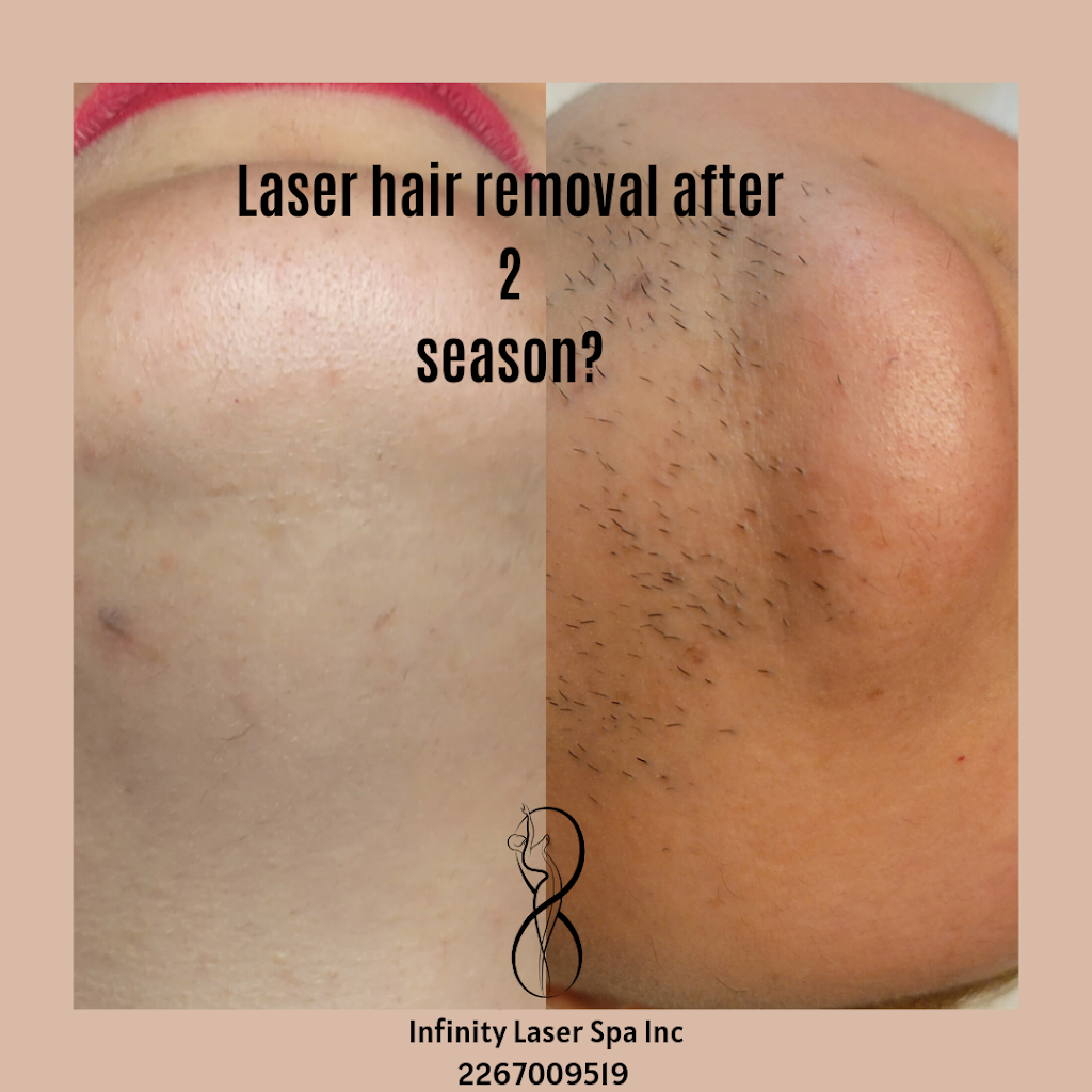 Infinity Laser Spa Inc. | 600 Hyde Park Rd, London, ON N6H 5W8, Canada | Phone: (226) 700-9519