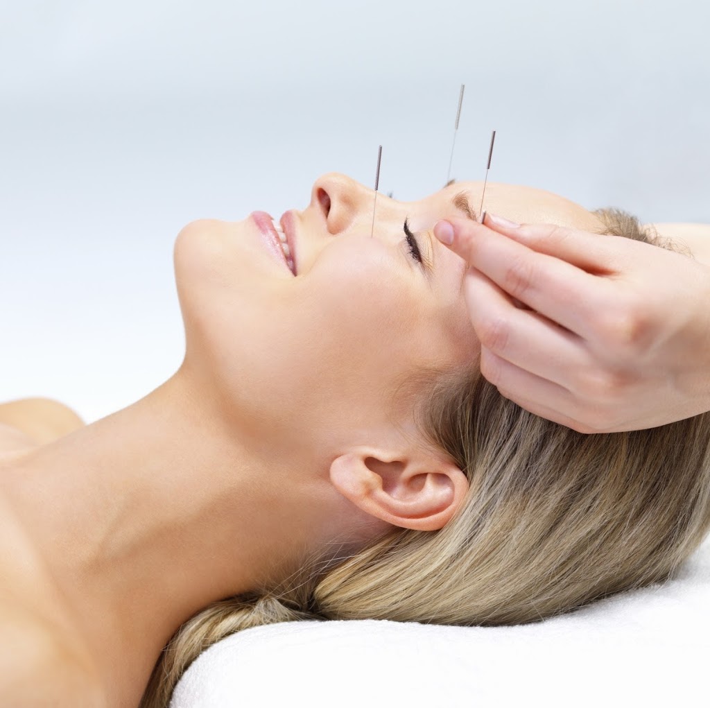 Acupuncture Sorel-Tracy | 306 Boulevard Gagné, Sorel-Tracy, QC J3P 5V5, Canada | Phone: (450) 808-3482