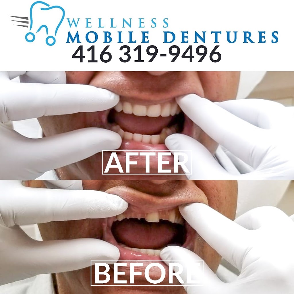 Wellness Mobile Dentures | Queensway W, Mississauga, ON L5B 2P7, Canada | Phone: (416) 319-9496