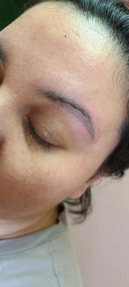 Emergency Removal - Eyebrow Tattoo Removal | 11675 Seventh Ave, Richmond, BC V7E 4X4, Canada | Phone: (672) 514-1790