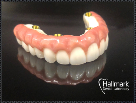 Hallmark Dental Laboratory Ltd | 224 Hobsons Lake Dr, Halifax, NS B3S 0G4, Canada | Phone: (902) 443-1211