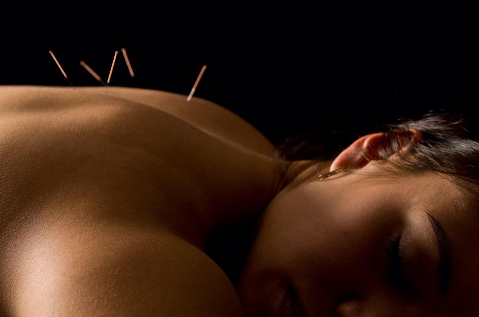 Acupuncture Lynne Bradley | 258 Boulevard Brien, Repentigny, QC J6A 6V2, Canada | Phone: (438) 275-3676