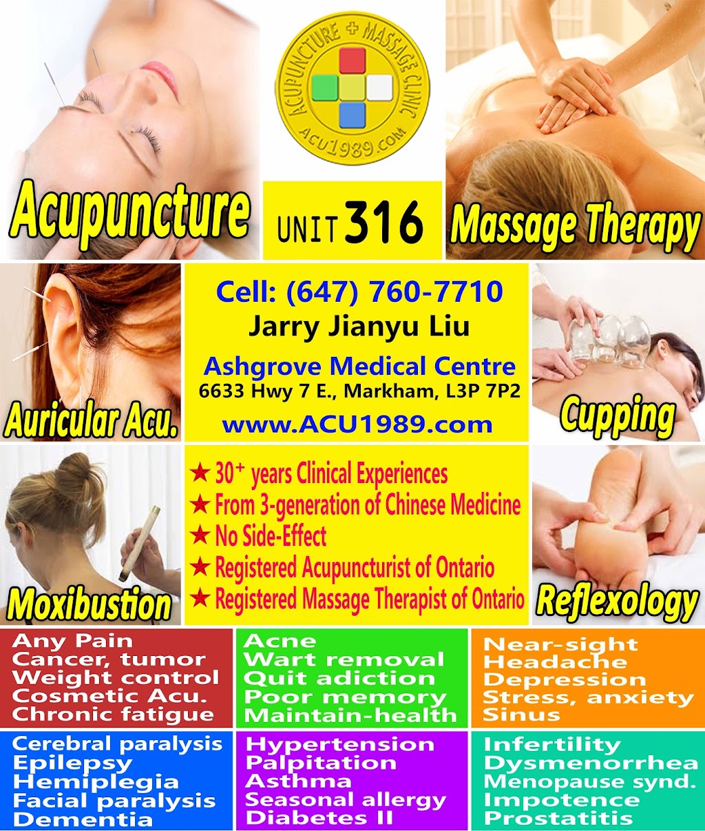 Acupuncture + Massage Clinic | 6633 Hwy 7 #316, Markham, ON L3P 7P2, Canada | Phone: (647) 760-7710