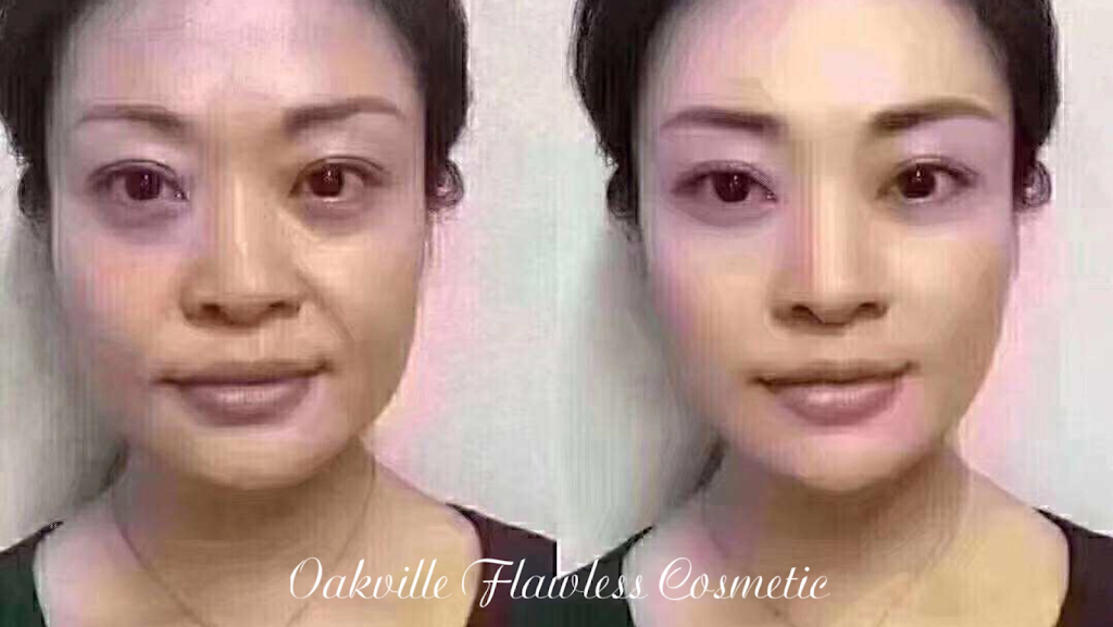 Oakville Flawless Cosmetic | 3075 Hospital Gate #109 First Floor Of North Oakville Medical Center, Oakville, ON L6M 1M1, Canada | Phone: (289) 885-5660