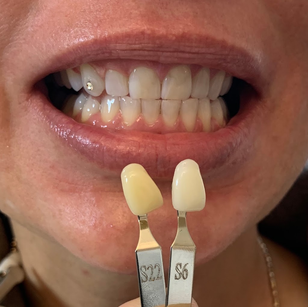 Tooth Gemist & Teeth Whitening Technician by Deanna | 32 Dorthy Dr, Trenton, ON K8V 5P5, Canada | Phone: (647) 466-1695