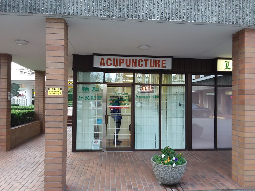 Langara Acupuncture Clinic | 613 W 57th Ave, Vancouver, BC V6P 1R8, Canada | Phone: (604) 324-9616