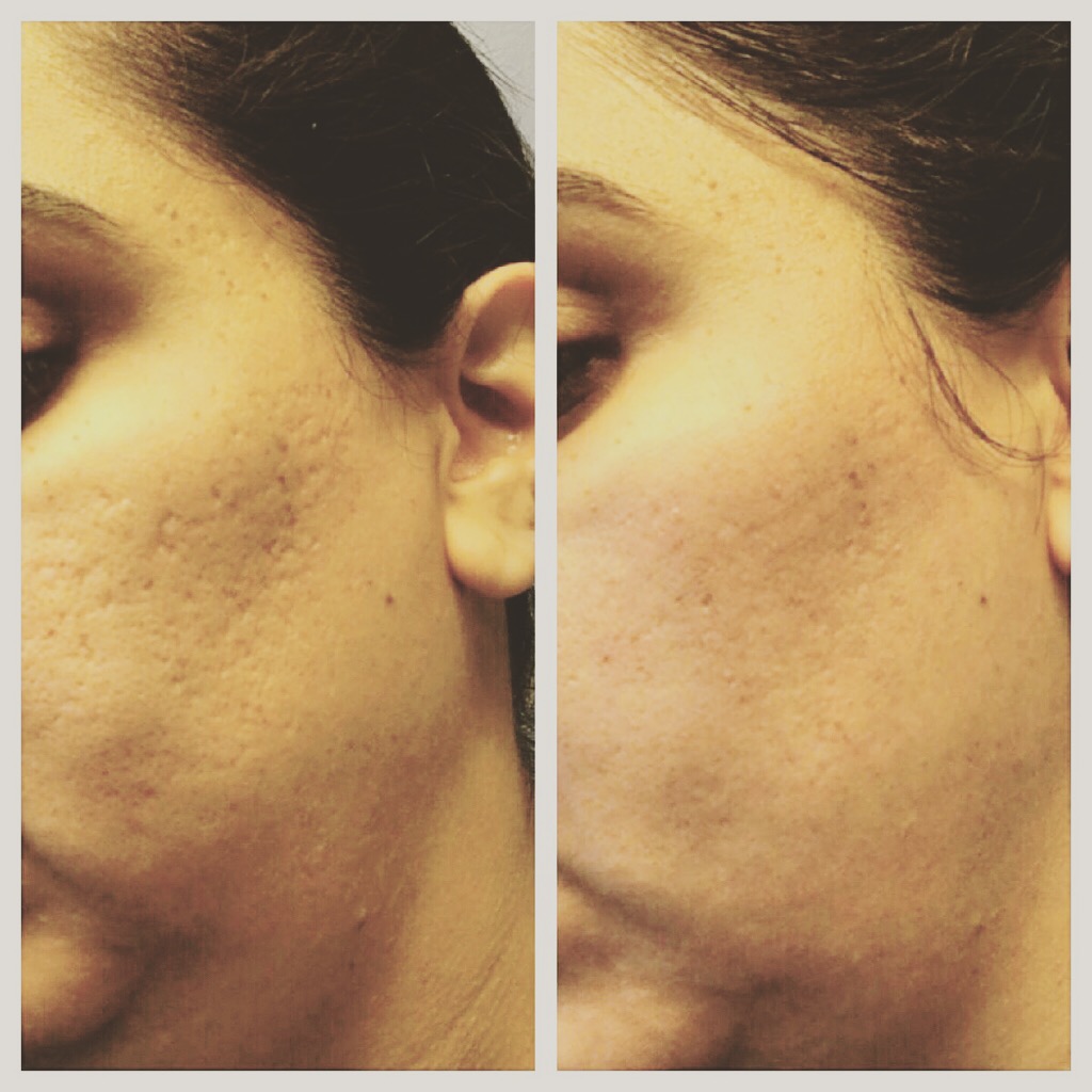 Contour Laser & Skin Concepts | 14012 32 Ave, Surrey, BC V4P 2J2, Canada | Phone: (604) 560-9500