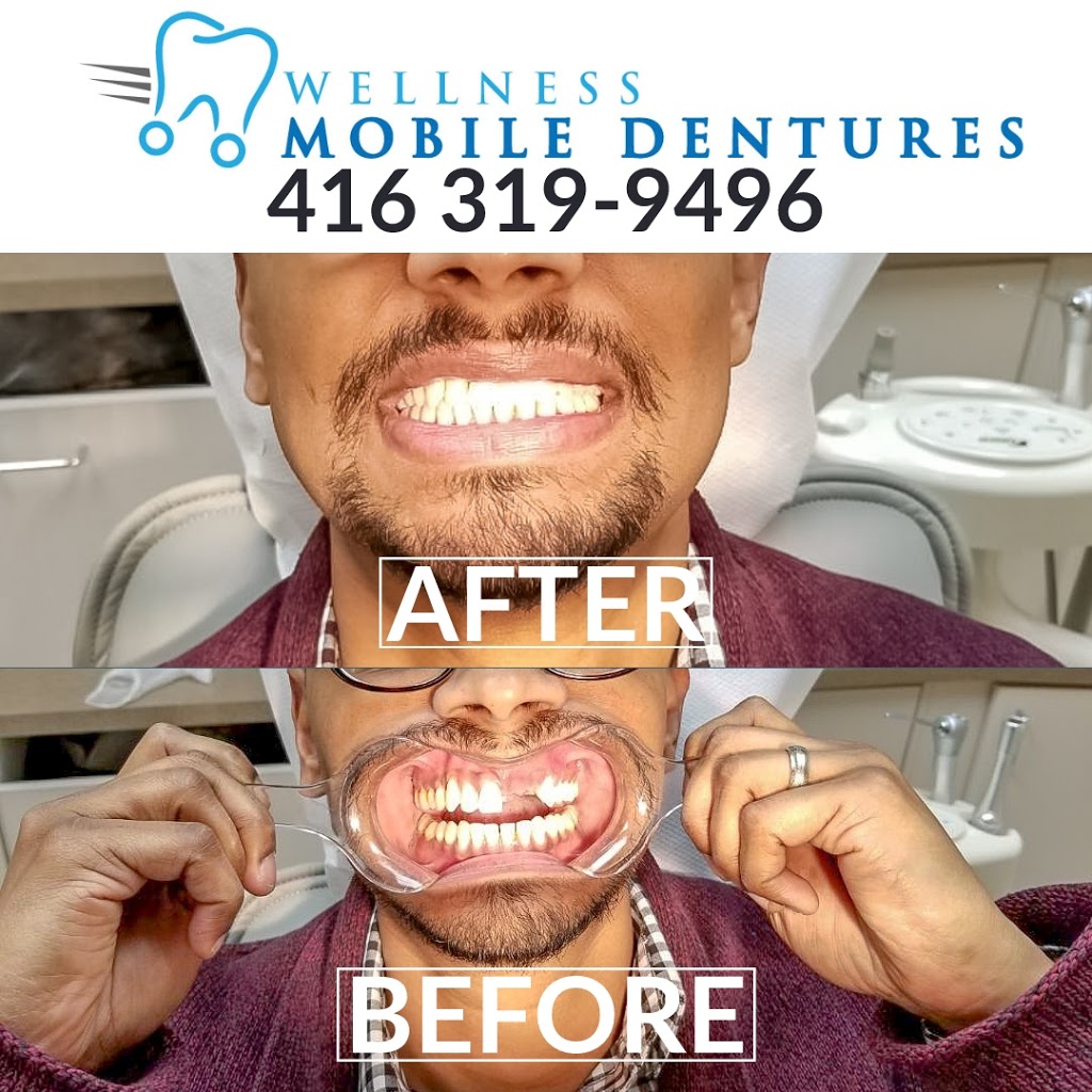 Wellness Mobile Dentures | Queensway W, Mississauga, ON L5B 2P7, Canada | Phone: (416) 319-9496