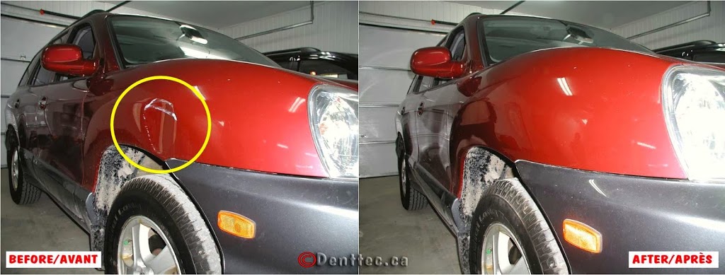 Dent Tec | 93 Rue Robert-Pilon, Gatineau, QC J9J 2X8, Canada | Phone: (819) 743-5252