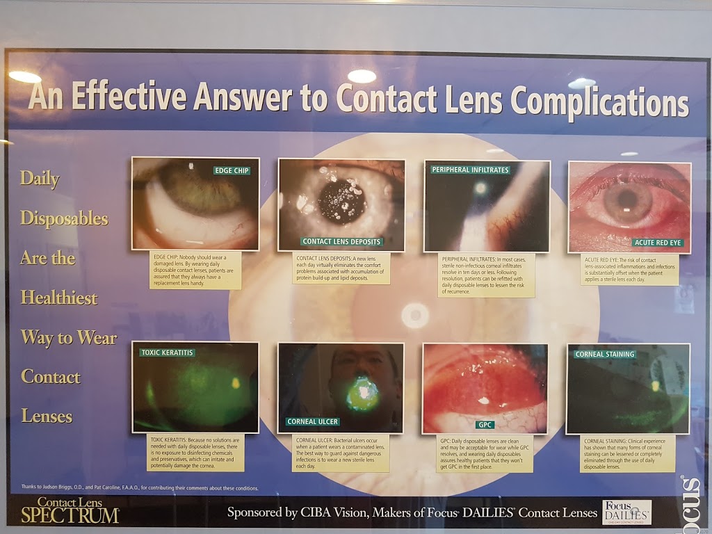 Contact Lens | 104-2235 Kennedy Rd, Scarborough, ON M1T 3G8, Canada | Phone: (416) 299-0865