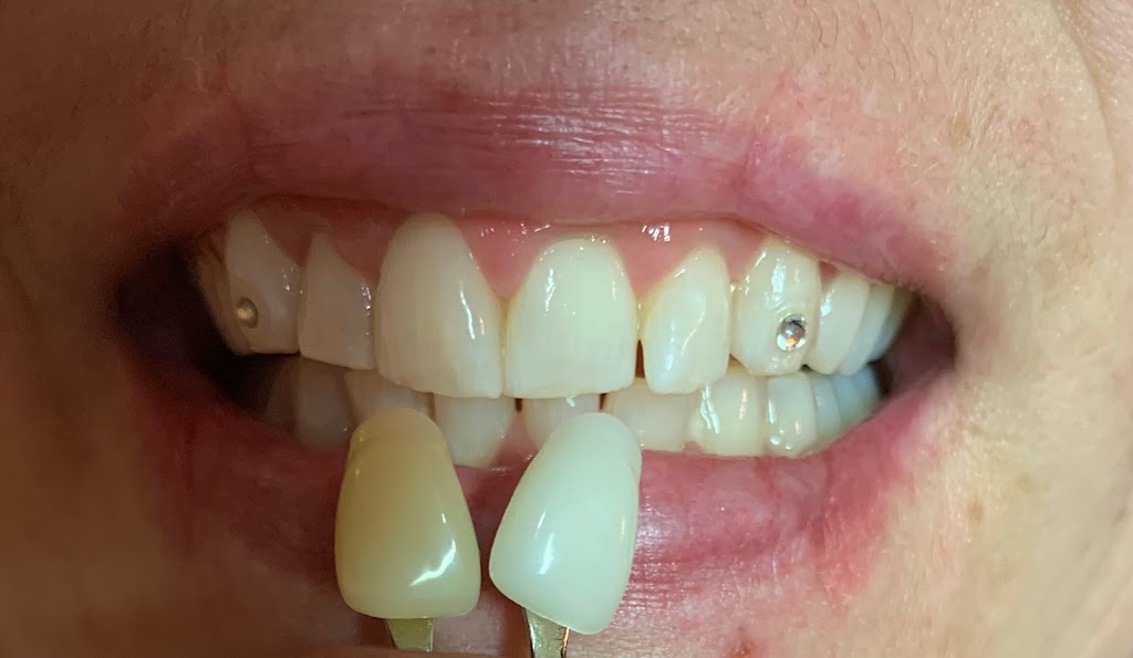 Tooth Gemist & Teeth Whitening Technician by Deanna | 32 Dorthy Dr, Trenton, ON K8V 5P5, Canada | Phone: (647) 466-1695