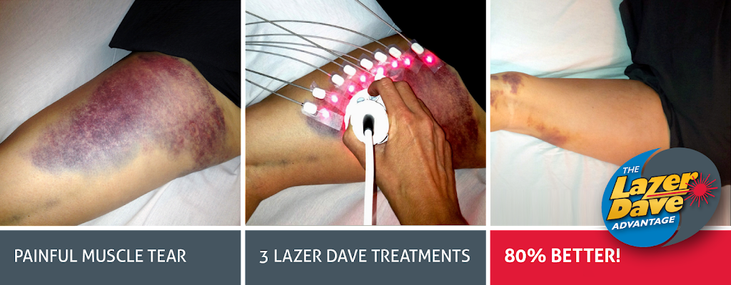 Ottawa Laser Solutions - NEPEAN | Physiocare Physiotherapy, 289 Greenbank Rd, Nepean, ON K2H 8K9, Canada | Phone: (613) 714-9495