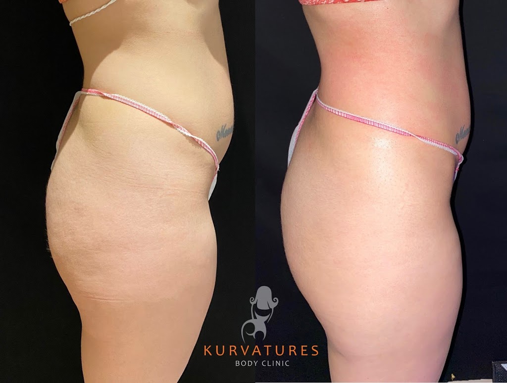 Kurvatures Body Clinic | 140 Woodbridge Ave Unit BU5, Woodbridge, ON L4L 4K9, Canada | Phone: (647) 390-7757