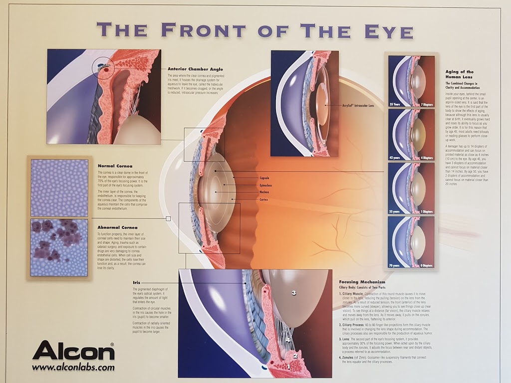 Contact Lens | 104-2235 Kennedy Rd, Scarborough, ON M1T 3G8, Canada | Phone: (416) 299-0865